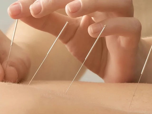 The Benefits of Acupuncture for Erectile Dysfunction: Fact or Fiction?